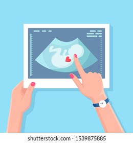 Ultrasound scan of baby. Shot of scanning pregnant woman. Medical diagnosis and consultation. Vector flat design 