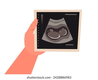 Ultrasound scan in hand. Baby ultrasound picture. Photo of ultrasound examination of infant. Cartoon vector illustration