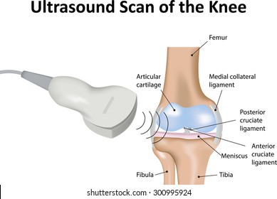 Ultrasound Scan of the Knee Joint