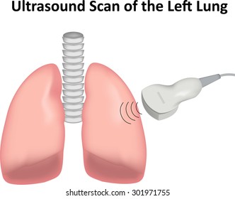 Ultrasound Scan of Lungs