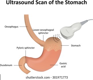 Ultrasound Scan of the Stomach