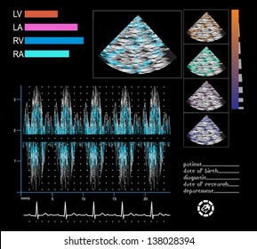 Ultrasound screen. Echo-cardiogram, phonocardiogram, electrocardiogram. 