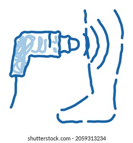 ultrasound treatment varicose veins sketch icon vector. Hand drawn blue doodle line art ultrasound treatment varicose veins sign. isolated symbol illustration