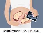 Ultrasound of a twin in the womb. Vector illustration in grayscale. An ultrasound image of a baby. Medicine and health of the fetus of twins. Realistic Embryo Sonogram