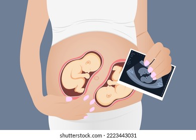  Ultrasound of a twin in the womb. Vector illustration in grayscale. An ultrasound image of a baby. Medicine and health of the fetus of twins. Realistic Embryo Sonogram