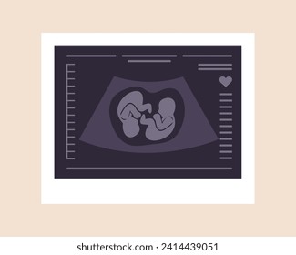 Ultrasound von Zwillingen. Embryonen im Gebärmutteralter. Schwangerschaftsscreening. Kinderkrankendiagnostik. Fetus silhouettes Foto. Sonographie oder Ultraschallkonzept. Vektorgrafik im flachen Cartoon-Stil.