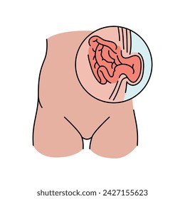 Umbilical hernia line icon. Vector isolated element. Editable stroke.