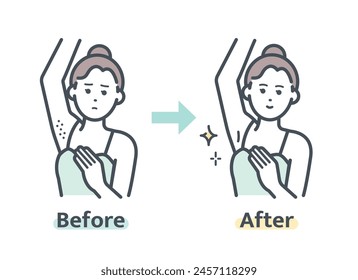 Underarm hair removal before and after