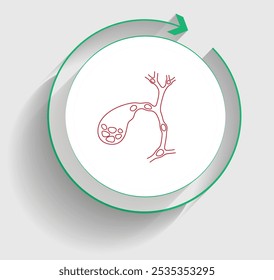 Understanding Bile Duct Stones Diagnosis and Management