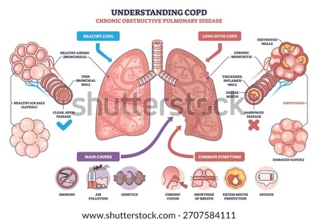 Understanding COPD, brief visual contrasts healthy lung with COPD lung, showing bronchi, mucus, and damaged alveoli to explain airflow obstruction and symptoms. Outline diagram