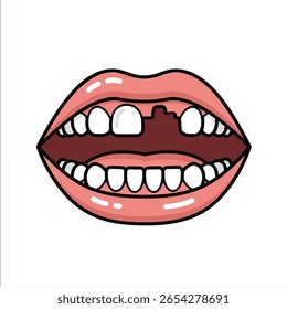 Understanding dentures and dental implants for missing teeth