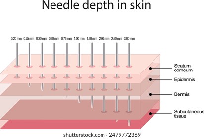 Verständnis der Tiefe der Nadelpenetration in der Mikronädelung und Kosmetik für optimale Hautverjüngung.