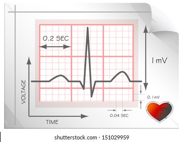 Understanding Heart ECG