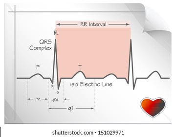Understanding Heart ECG