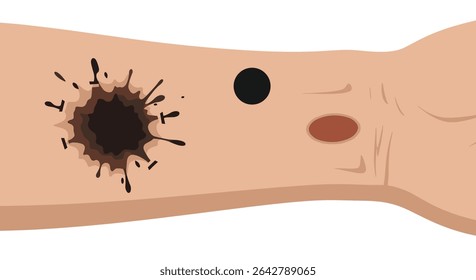 Understanding The Types Of Spots On Skin Causing Concern And Potential Remedies