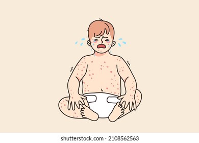 Unhappy baby infant crying suffer from eczema or dermatology disease. Upset sad little kid newborn child stressed with measles or chickenpox. Children healthcare concept. Vector illustration. 