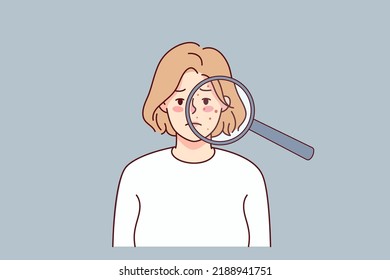 Unhappy woman with acne on face under magnifying glass. Upset young female suffer from skincare problems. Dermatology and cosmetology. Vector illustration. 