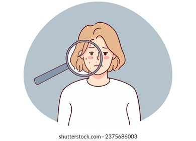 Unhappy woman with acne on face under magnifying glass. Upset young female suffer from skincare problems. Dermatology and cosmetology. Vector illustration.