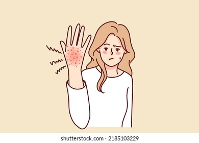 Unhappy woman suffer from redness on hand. Unwell girl struggle with psoriasis or seasonal allergy. Healthcare concept. Vector illustration. 