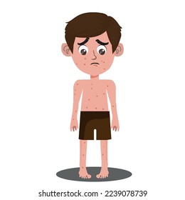 Unhealthy boy with red spots on body suffer from measles or rubella. Anxious unwell kid struggle with rash fever, have severe symptoms. Healthcare concept. Flat vector illustration.