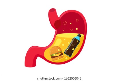 Unhealthy Eating Fast Food Burger Soda And Gastric Juice In Stomach. Human Digestive System Organ Indigestion Problems. Vector Isolated Illustration