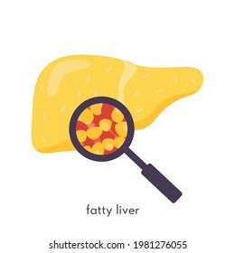 Unhealthy fatty liver. Damaged human organ under magnifying glass. Medical research study of fat liver tissue. Vector illustration in flat cartoon style isolated on white.