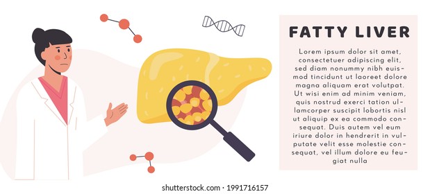 Hígado adiposo no saludable. Órgano humano dañado bajo lupa con hepatólogo. Concepto de investigador médico o médico que estudia el tejido hepático graso. Pancarta educativa vectorial al estilo de las caricaturas planas.