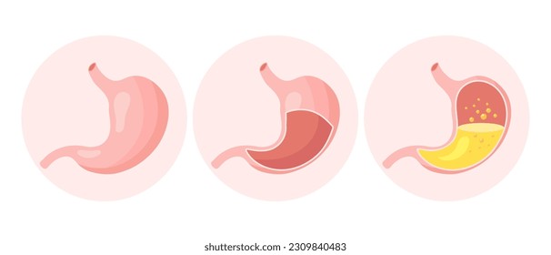 Unhealthy human stomach, medical icons set. Gastritis, ulcer, stomach pain, bloating. Anatomy of the digestive system. Vector	
