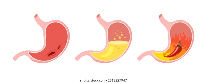 El estómago humano no saludable, los íconos médicos se ponen. Gastritis, úlcera, dolor de estómago, hinchazón. Anatomía del sistema digestivo.