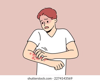 Unhealthy man scratch red pimples on arm suffer from allergy or dermatitis. Stressed unwell guy suffer from itchiness and redness. Healthcare. Vector illustration. 