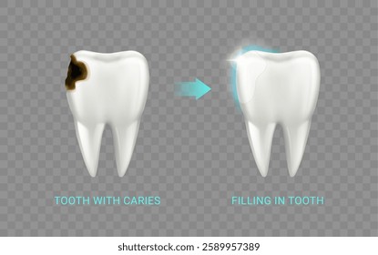 Unhealthy molar with decayed area with visible pits and holes and restored tooth with filling with smooth, contoured surface. Vector restore teeth function and shape, dental prosthetics