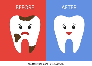 an unhealthy tooth and a healthy tooth. Vector illustration