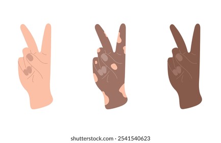 Gesto universal de mão de paz. Ilustração vetorial desenhada à mão em estilo plano. Branco, preto e vitiligo pele hippie mostra dois dedos, símbolo de vitória, sinal V. Comunicação corporal não verbal