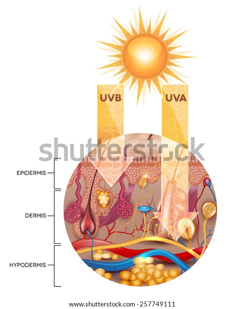 Unprotected Skin Without Sunscreen Lotion Uvb Stock Vector (Royalty ...