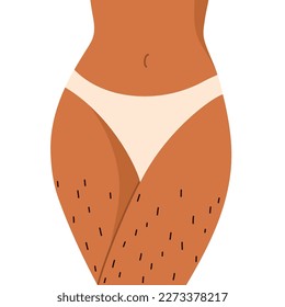 Unshaved hairy female legs. Body positive, normalize female body hair, skin care. Vector illustration in cartoon style. Isolated white background.	
