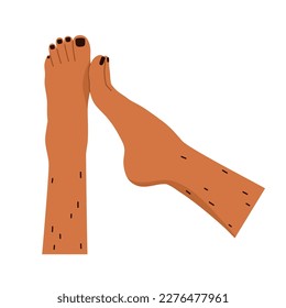 Unshaved hairy female legs. Body positive, normalize female body hair, skin care. Vector illustration in cartoon style. Isolated white background.