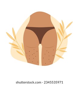 Unshaved hairy girl body. International Women Day. Vector female legs and buttocks with hair. Body positive poster. Depilation or epilation.