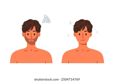 Unshaven man was transformed and became handsome after using razor with sharp blade. Guy recommends new shaving foam or high-quality razor that allows you to avoid discomfort and itching