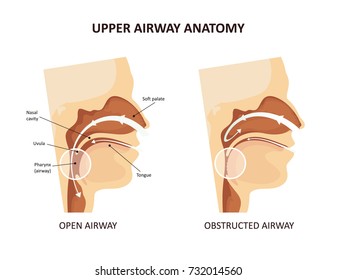 Upper airway anatomy. Snoring and sleep apnea