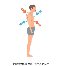 Upper crossed syndrome medical diagram. Crooked man with muscle strength imbalance. Weak and overactive muscles therapy. Incorrect spine curvature caused by bad posture. Vector illustration.