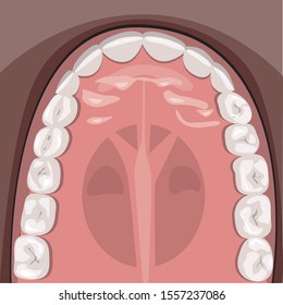 A upper jaw of an adult with wisdom teeth, incisors and molars for design. A vector illustration with healthy teeth for orthodontist or dentist. Teeth after treatment for medicine or education.