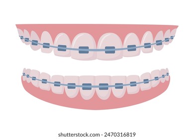 Upper and lower jaws with braces on teeth. Orthodontics and aesthetic dentistry medicine. Healthy smile. Dentistry, whitening, orthodontics. Vector