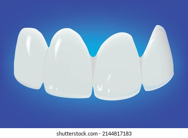 upper and lower palate dental apparatus dental prosthesis-
