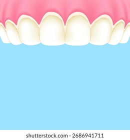 Dentes superiores (tártaro) - Projeto vetorial de ilustração com banner de caixa de texto (quadrado). Conceito de tratamento dentário.