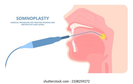 Otorhinolaryngologie-Chirurg operiert zur Behandlung der Krankheit am Nacken