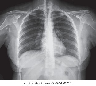 Upright Chest X-Ray for Medical Research and Teaching, vector illustration