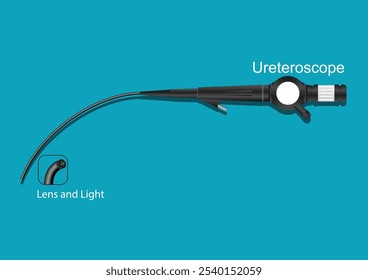 Ureteroscopia é um procedimento para abordar cálculos renais, e envolve a passagem de um pequeno telescópio, chamado ureteroscópio, através da uretra e bexiga, equipamento médico, ilustração vetorial. 