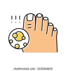 Uric Acid Crystals Gout Color Icon Vector. Uric Acid Crystals Gout Sign. Isolated Symbol Illustration