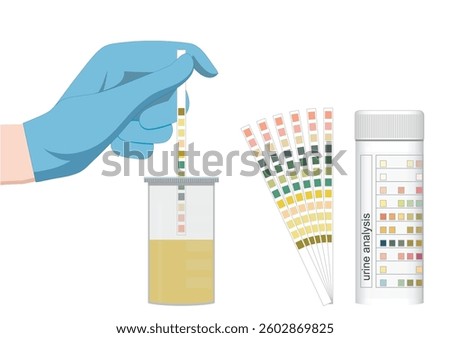 A urinalysis is a test of urine to check for a urinary tract infection, kidney problems, or diabetes.It can also monitor some medical conditions and treatments.medical healthcare ,vector illustration.