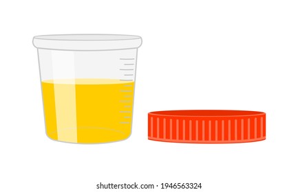 939 Urinalysis Stock Illustrations, Images & Vectors | Shutterstock